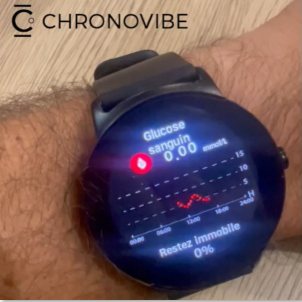 Diabeto Ultra - La montre connectée glycémie